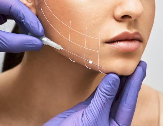 Thread Lift